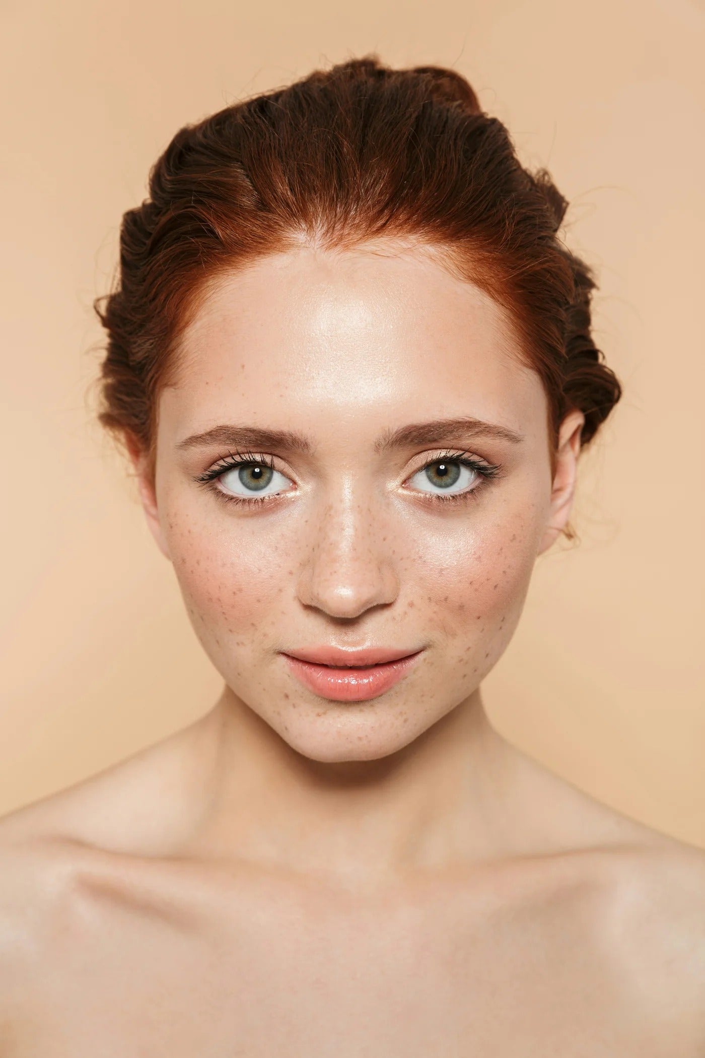 Before treatment image